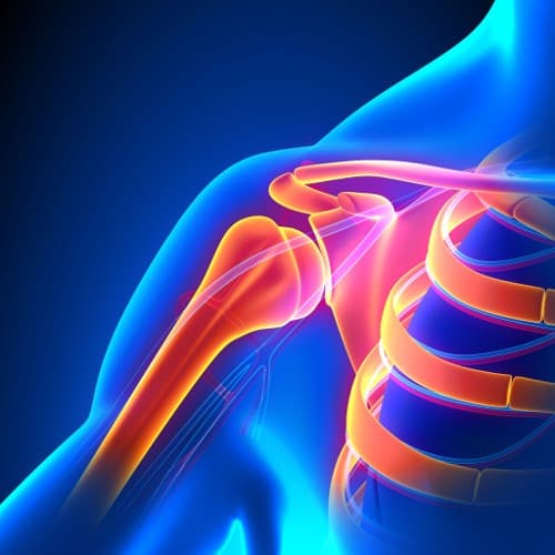 Radiografische gewrichtsschade bij PsA in kaart gebracht