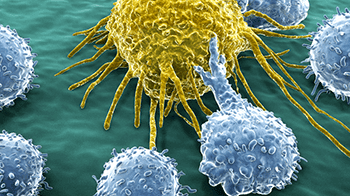 Biologicals teleurstellend bij ernstig COPD met eosinofiele inflammatie