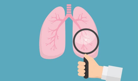 Inzicht in number needed to treat voor biologicals bij COPD
