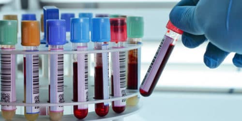 Risicofactoren en biomarkers voor verhoogd exacerbatierisico bij ernstig astma