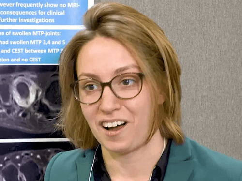 ACR 2019: Video 1 met Xanthe Matthijssen, LUMC Leiden