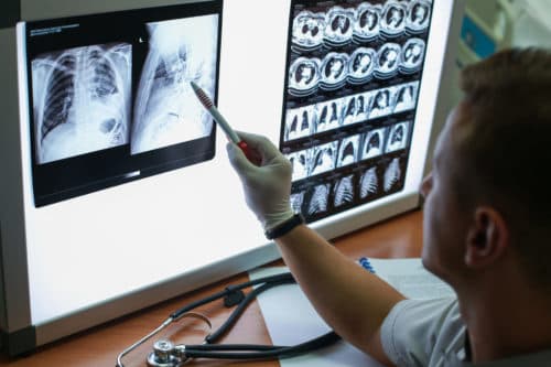 Fysieke activiteit blijkt sleutel tegen vermoeidheid bij COPD