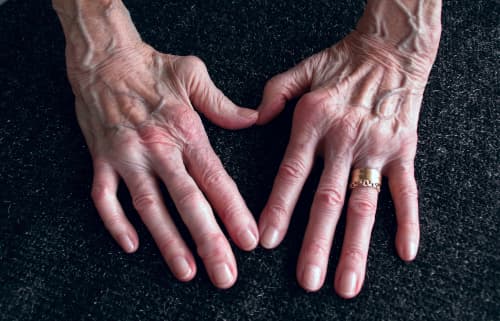 Zinnig en zuinig gebruik van biologicals