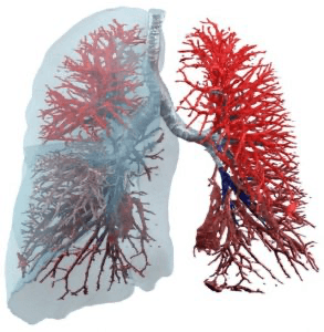 AI-meting van myosteatose in hart-CT voorspelt COPD