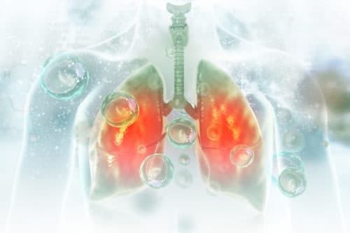 ERS 2021: Multiplex bacteriële PCR in BAL inzetbaar in strijd tegen antibioticaresistentie