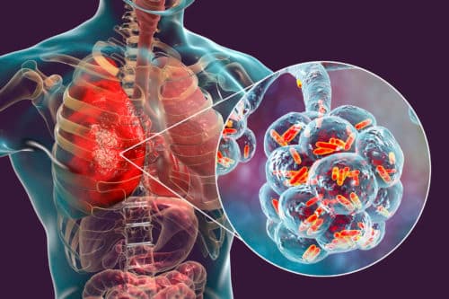 Verstoring van microbioom en longinflammatie door antibiotica