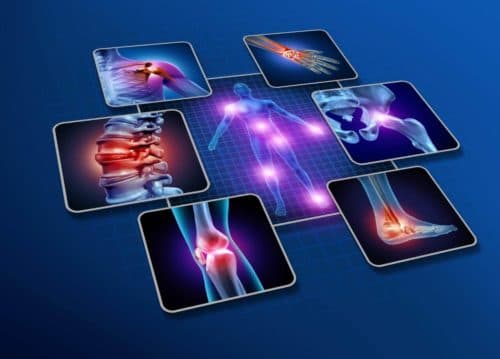 Secukinumab langdurig effectief bij PsA en AS in real-world data