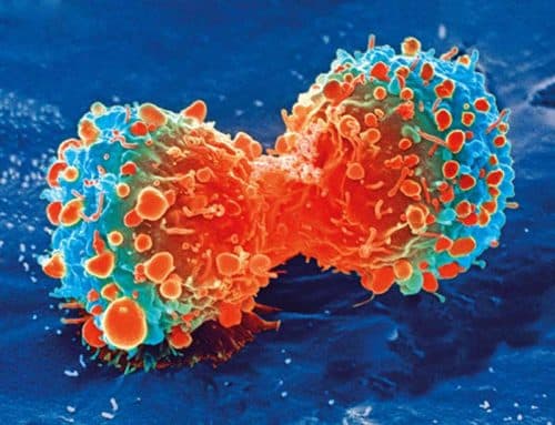 SBRT plus IO even effectief als chemo-IO bij stadium IB-IIIB NSCLC