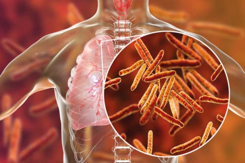 Screening op infectieziekten voor start met biologicals