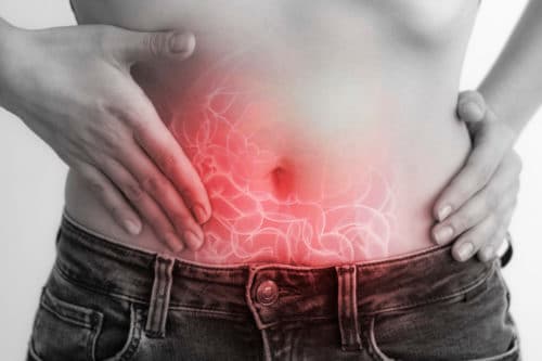 Vaker ankyloserende spondylitis bij patiënten met colitis ulcerosa