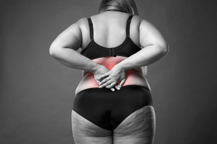 Bariatrische chirurgie gunstig bij obese RA-patiënten