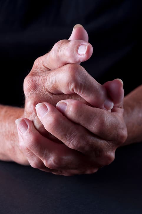 Hydroxychloroquine voorkomt RA niet bij seropositieve risicogroep