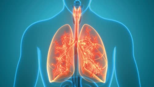 Bronchoscopische interventies bij ernstig COPD