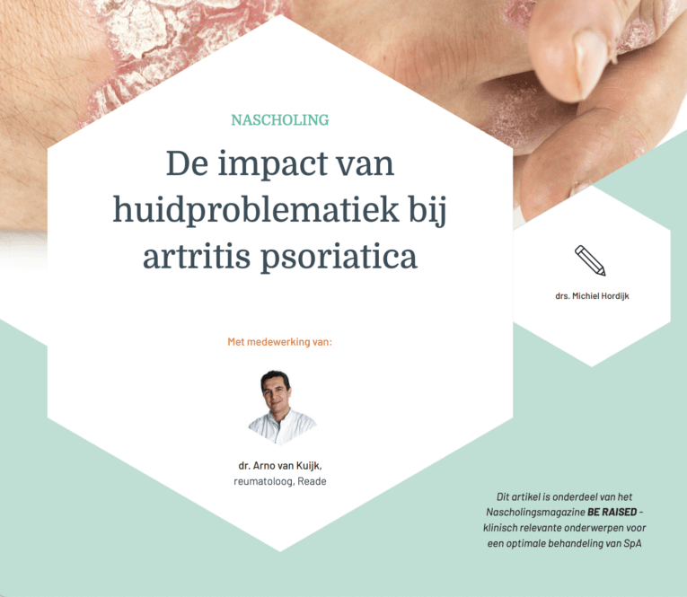 Huid- en nagelafwijkingen bij artritis psoriatica