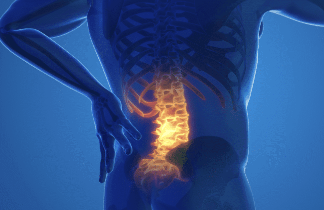Nieuw: e-learning Actuele ontwikkelingen rond spondyloartritis en artritis psoriatica